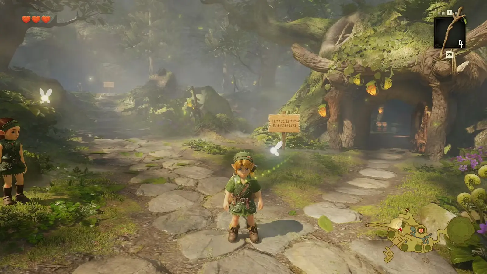 Zelda Ocarina of Time Remake trên Switch 2